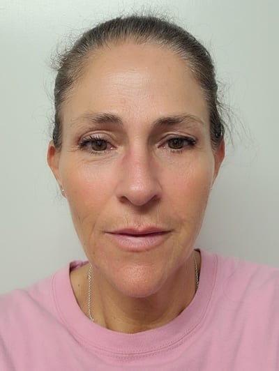 abilene-lmt-cynthia-zerr-otmsa-instructor Profile picture of one of OTSMA's Licensed Massage Therapist Instructors who also offers Continuing Education. She teaches all aspects of the curriculum and specializes in teaching cupping.